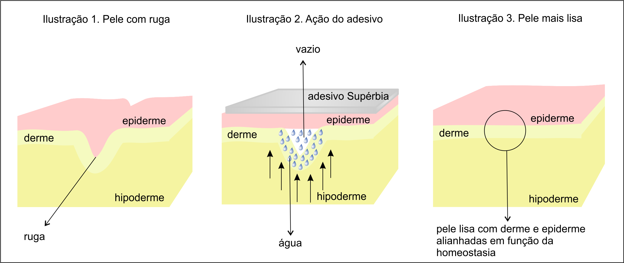 esquema da pele